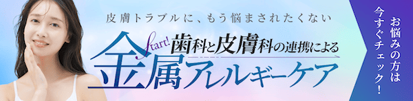 金属アレルギーバナー