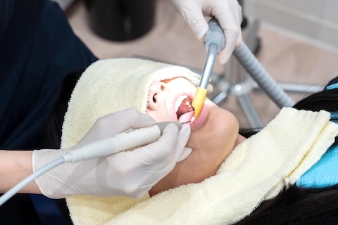 長久手さくら歯科・矯正歯科スタッフの診療中の様子